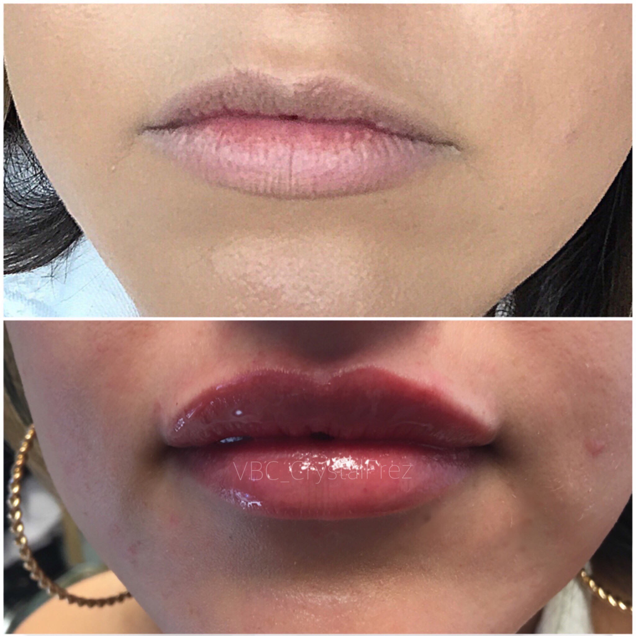 Vivid Beauty Clinic In Denver CO Vagaro